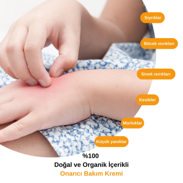 HYDROMİEL Urla’dan Acil Durum Kremi