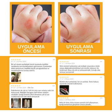 HYDROMİEL Urla’dan Acil Durum Kremi